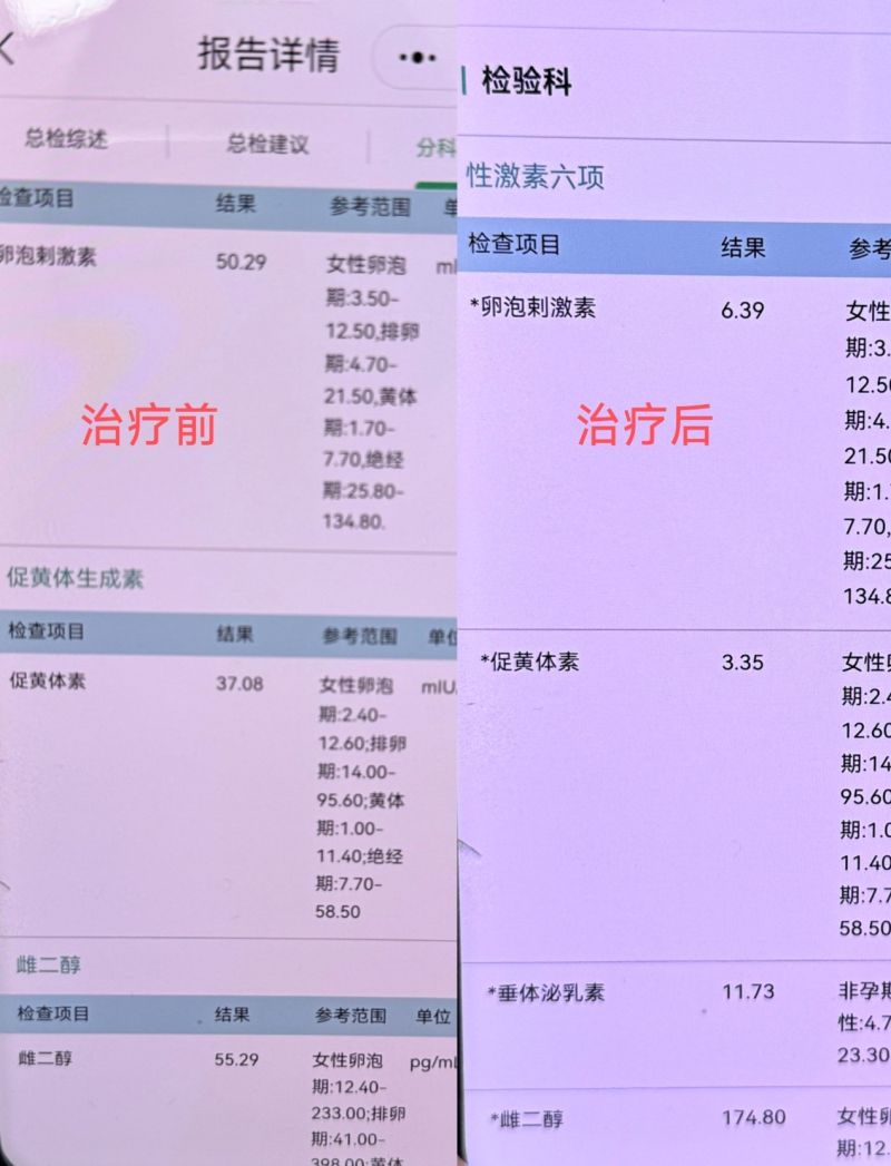前后对比图1.jpg