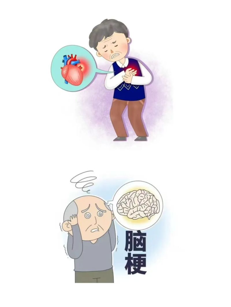 健康科普 | 冬季高发！心梗脑梗防护指南来啦